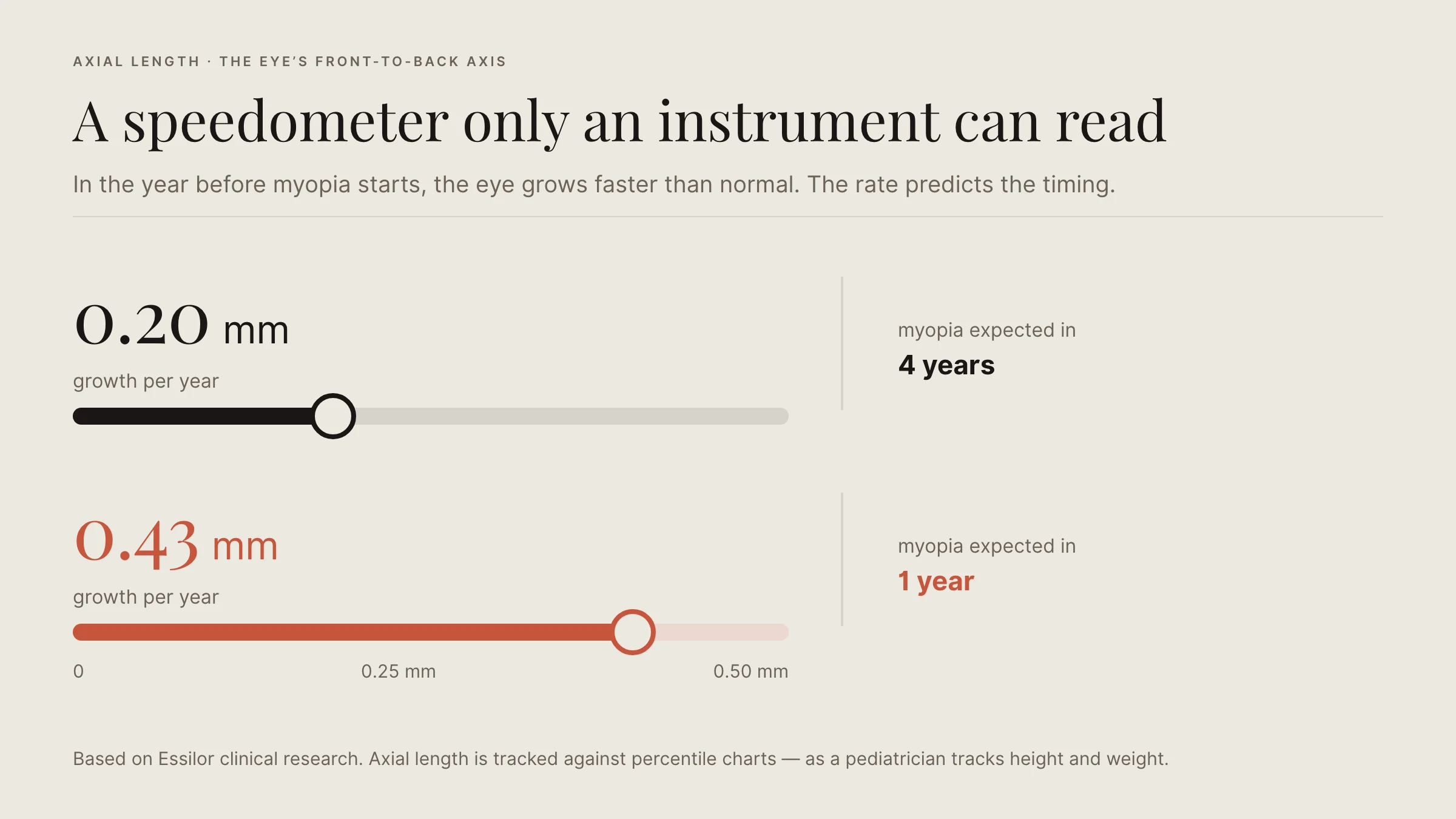Chart: axial growth of 0.20 mm per year predicts myopia in four years; 0.43 mm predicts one year