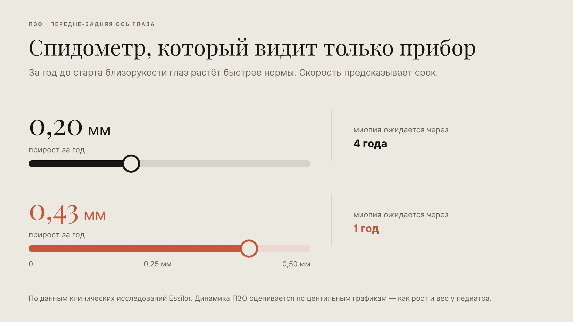График: прирост ПЗО 0,20 мм в год — миопия через 4 года; 0,43 мм — через 1 год